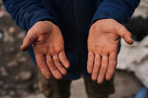 Hikmet Kilic shows his hands as he works gathering discarded cartons and plastic bottles in Istanbul, Turkey, Tuesday, March 4, 2025. (AP Photo/Francisco Seco)